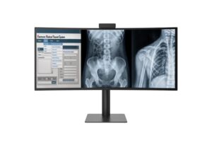LG Electronics presenta monitor de diagnóstico ultrawide curvo de 40 pulgadas